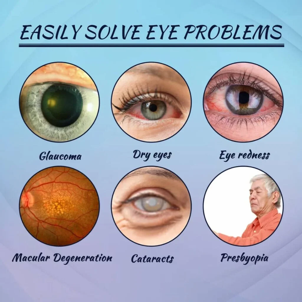 Easily Solve Eye Problems: Glaucoma, Dry eyes, Eye redness, Macular Degeneration, Cataracts, Presbyopia