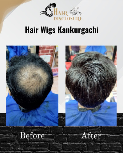 Hair wigs Kankurgachi - Hair Disclosure.jpg