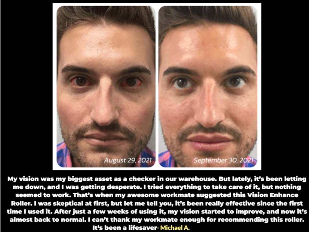 Michael A. Before and After Vision Improvement Result