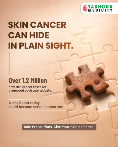 Skin Cancer Awareness – Recognise the Signs and Protect Your Skin Yashoda Medicity.jpg