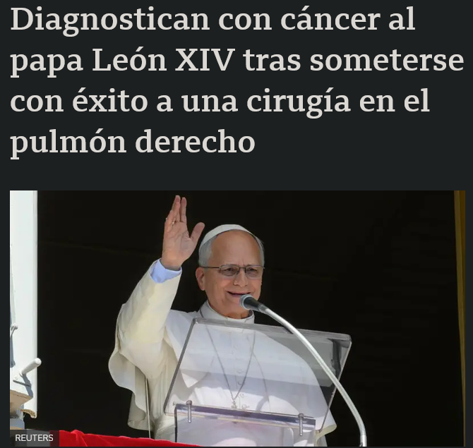 nXnNbRI.png