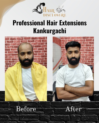 Professional Hair Extension in Kankurgachi - Hair Disclosure.jpg