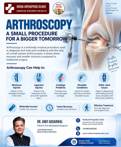 Arthroscopy Treatment for Joint Problems in Noida.jpg