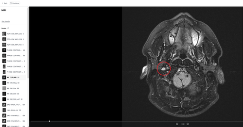 right sigmoid