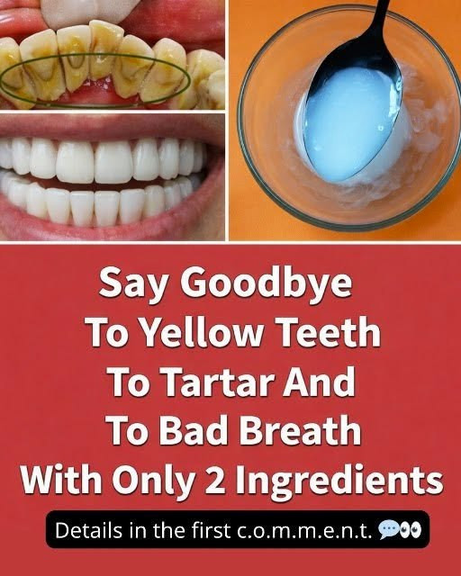 Say Goodbye to Yellow Teeth, Tartar, and Bad Breath With Only 2 Simple Ingredients