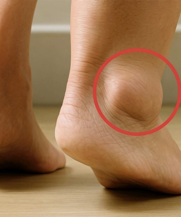 If Your Feet Swell, It May Be a Sign That…