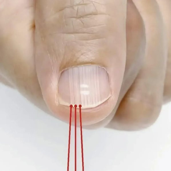If you have these lines on your nails after 40, it is a clear sign that..