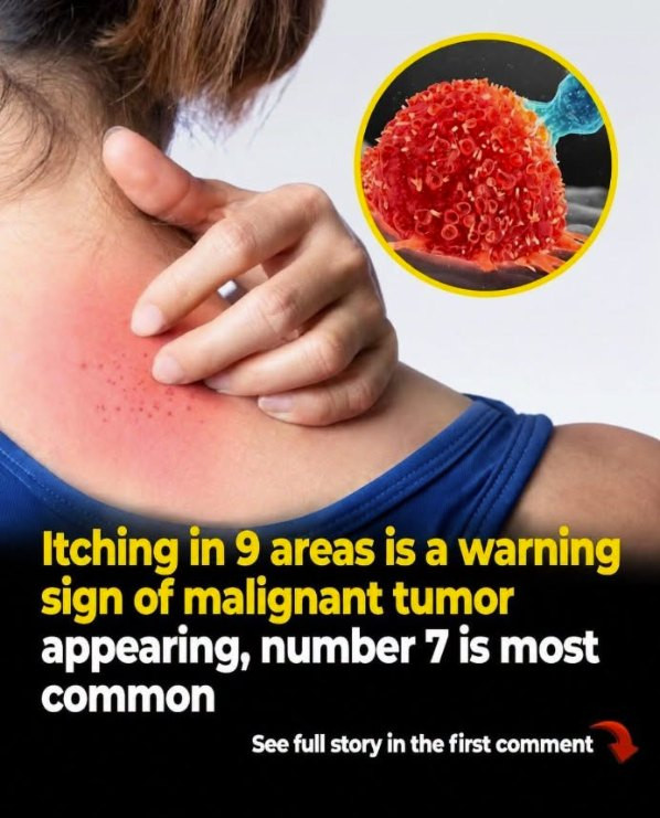 Don’t Ignore It: Persistent Itching in These 9 Areas Could Point to an Underlying Problem