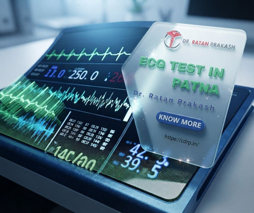 Best ECG Test in Patna: Dr. Ratan Prakash.jpg