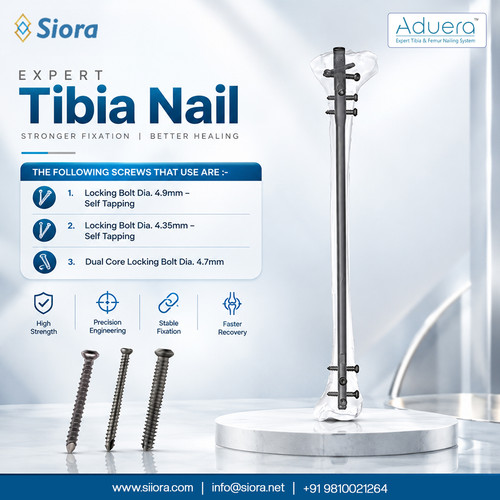 Expert Tibia Nail Titanium.jpg