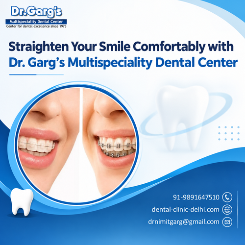 Straighten Your Smile Comfortably with Dr. Garg’s Multispeciality Dental Center.png