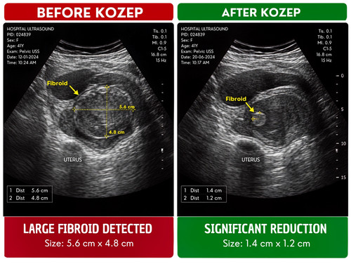 Before and After KOZEP.jpg