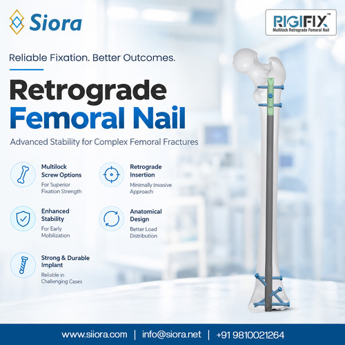 Retrograde Femoral Nail.jpg