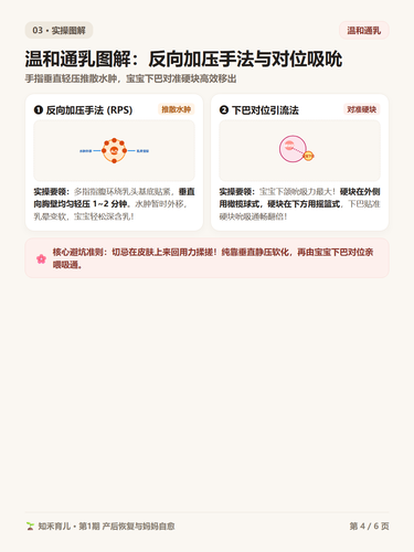 15 P4 温和通乳 反向加压与对位引流图解.png
