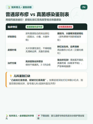 16 P4 鉴别诊断 普通尿布疹与念珠菌真菌识别.png