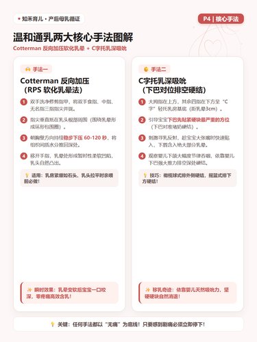 15 P4 温和通乳 反向加压与对位引流图解.png