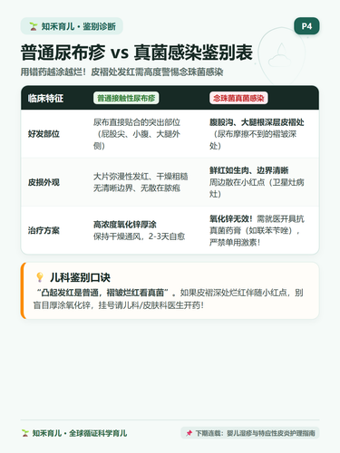 16 P4 鉴别诊断 普通尿布疹与念珠菌真菌识别.png