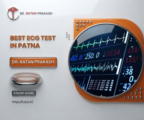 Best ECG Test in Patna: Dr. Ratan Prakash.jpg