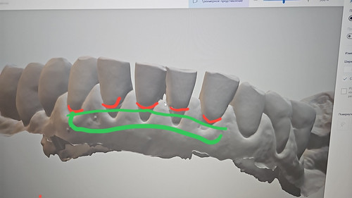 clinical case.jpg