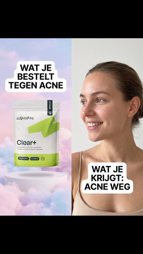 pad 10 wat ik bestelde.1