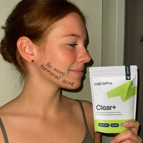 u07 no more hormonal acne.png