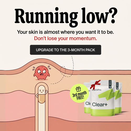 u41 running low.png