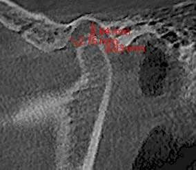 clinical case.jpg