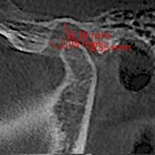 clinical case.jpg
