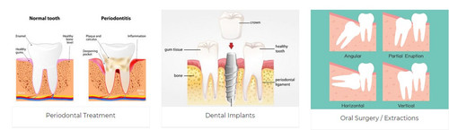 Tamara Rojas D.M.D., P.A
5000 Hollywood Blvd Suite #4
Hollywood, FL 33021
(954) 963-4700
http://www.toothfairyworkshop.com/fort-lauderdale/