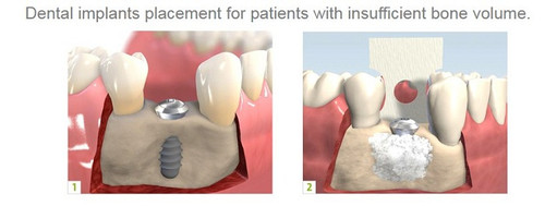 Tamara Rojas D.M.D., P.A
5000 Hollywood Blvd Suite #4
Hollywood, FL 33021
(954) 963-4700
http://www.toothfairyworkshop.com/fort-lauderdale/