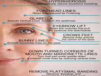 Dysport Treatment Austin Tx.jpg