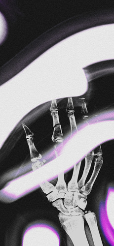 X Ray hand.jpg