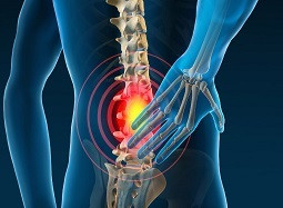 car accident chiropractor.jpg