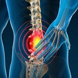 car accident chiropractor