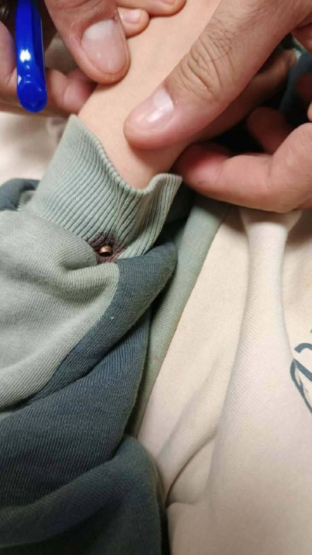 إصابة طفل بشظايا رصاص الاحتلال في بلدة سيلة الحارثية، غرب جنين....