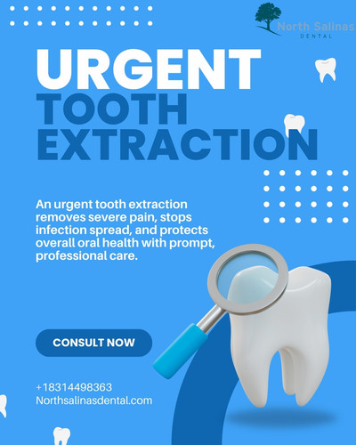 Urgent Tooth Extraction in Salinas – Same-Day Care.jpg
