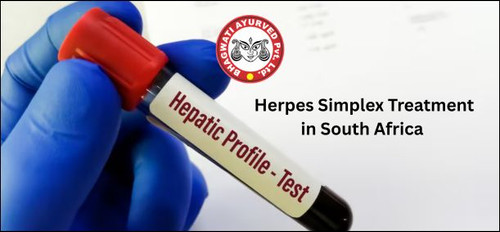 Herpes Simplex Treatment in South Africa - Bhagwati Ayurved.jpg