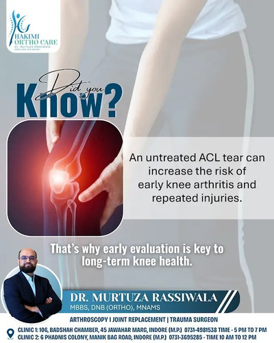 Why You Shouldn't Ignore an Untreated ACL Tear.jpg
