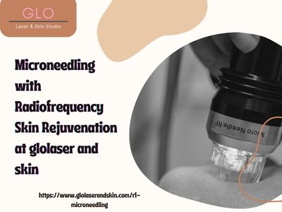 Microneedling with Radiofrequency | Skin Rejuvenation at glolaser and skin.jpg