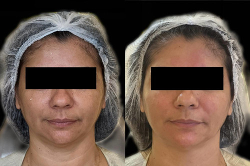 before after 4 D3MncJwK.jpg