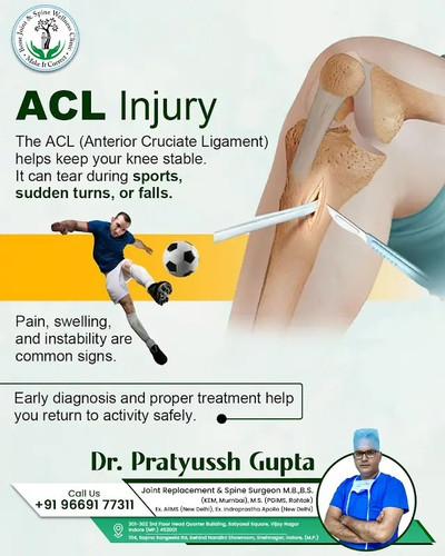 Understanding ACL Injuries Signs, Causes, and Recovery.jpg