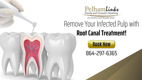 If you are experiencing sensitivity or sustained pain, contact Pelham Links Family and Cosmetic Dentistry. We offer a root canal procedure to remove the infection and prevent further damage to the tooth. Call (864) 297-6365 to book an appointment today!