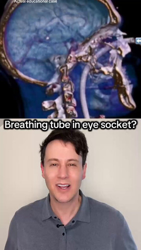 pTTfJ0WedzrDLjIk.jpg