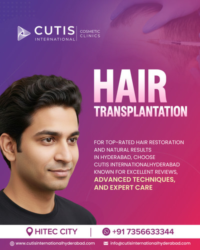 Why Choose Best Hair Transplant Clinic Hyderabad?.jpg