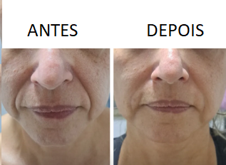 fsSZJDu.png