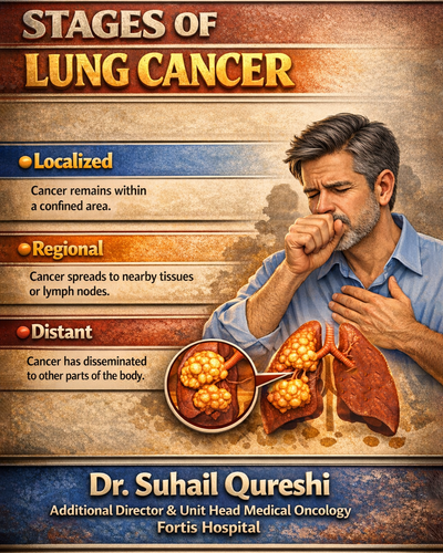 Dr-suhail-qureshi-stages-of-lung-cancer-medical-oncologist.png.png