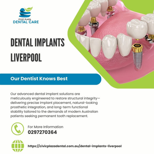 Osseointegrated Precision Advanced Dental Implants in Liverpool for Structural Renewal.jpg