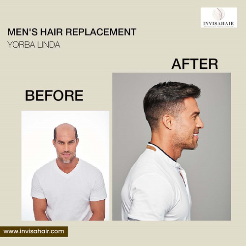 Men's hair replacement Yorba Linda.jpg