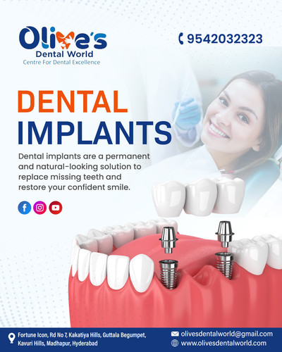 Are Dental Implants Safe and Long Lasting?.jpg