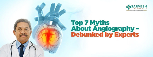 top7 myths about angiography debunked by experts.png